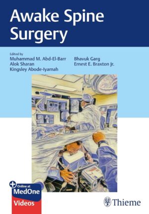 Awake Spine Surgery Without Videos